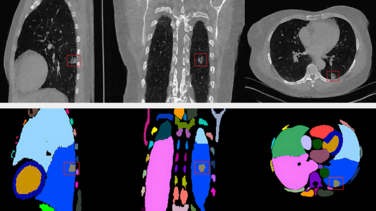 Breaking Barriers in Healthcare with New Models for Generative AI and Cellular Imaging