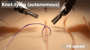 New AI Research Foreshadows Autonomous Robotic Surgery