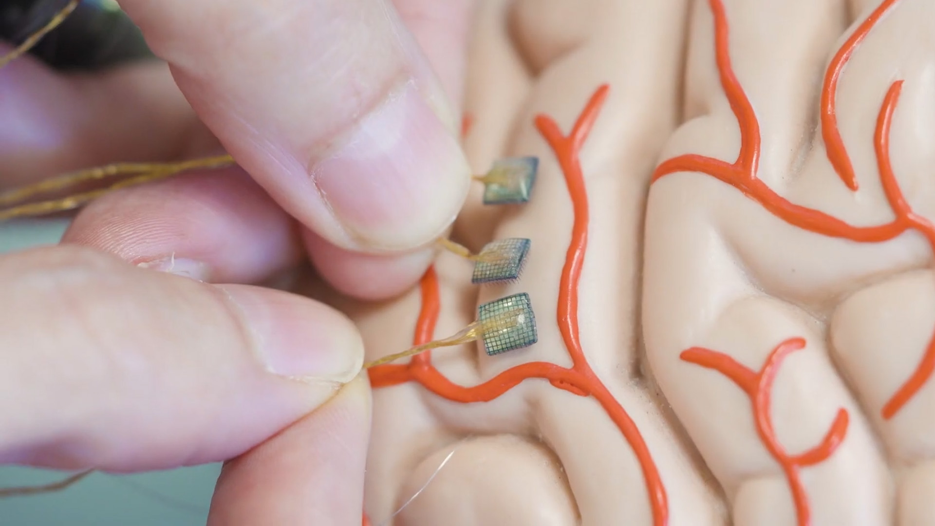 New two-way brain-computer interface has returned motion AND sensation to a paralysed test patient: ‘Right now, we just know the results are significant and leading to functional and meaningful outcomes’