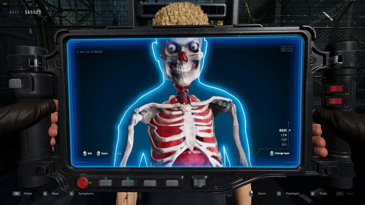 Quarantine Zone has been patched so now you can actually detect people smuggling hand grenades in their butts