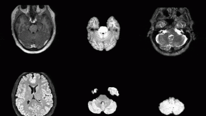 Synthesize Realistic 3D Medical Images at Scale to Ship Pre‑Trained Models