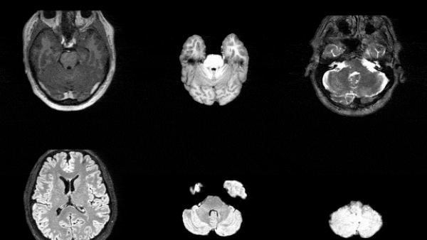 Synthesize Realistic 3D Medical Images at Scale to Ship Pre‑Trained Models